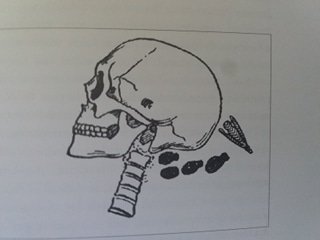 Drawing of archeology excavation showing skull with metal finial
